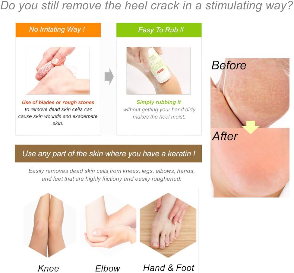 Purederm- Moisturizing Heel Crack Remover (Original)