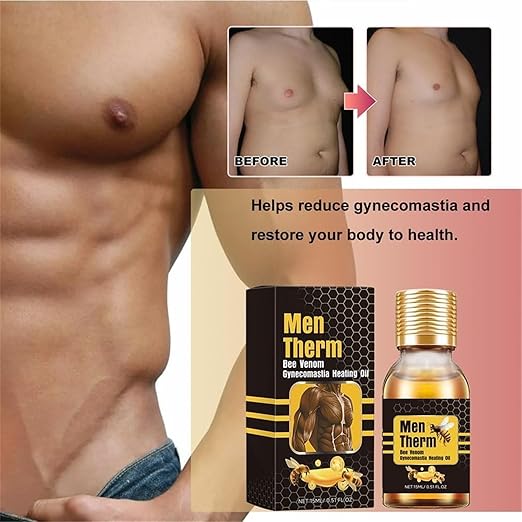 Men Therm - Bee Venom Gynecomastia Heating Oil (Original)